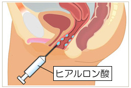 濡れたカズノコ天井（２）