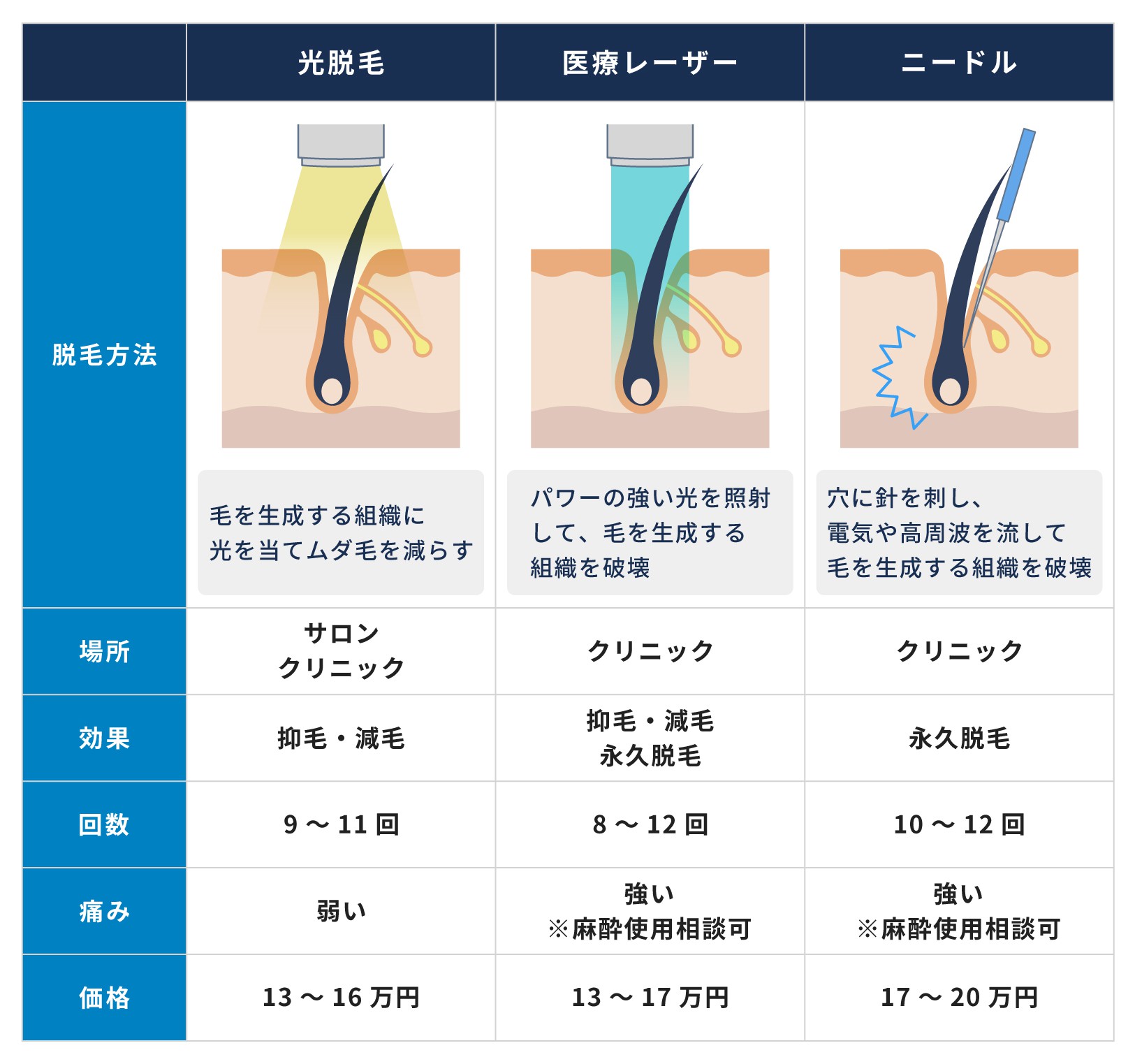 上野でメンズ脱毛・ヒゲ脱毛がおすすめの人気の医療クリニック＆サロン17選