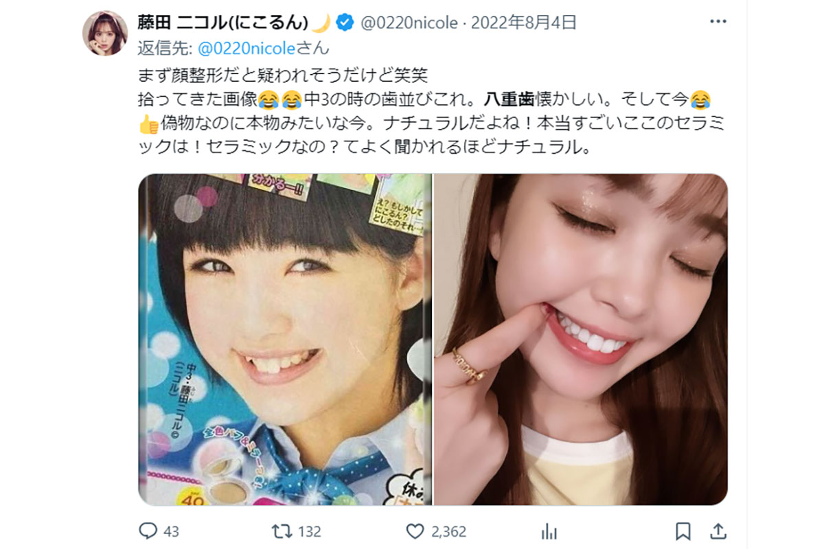 比較画像93枚】板野友美(トモちん)整形前の昔の顔が別人過ぎる説！ | 芸能人の裏ニュース