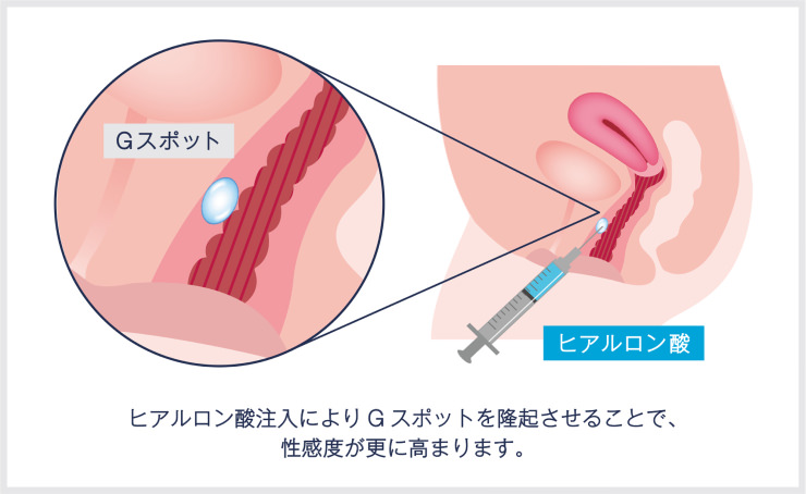 経験女性に聞いた性感帯の開発方法とオーガズムに達する気持ち良い部位