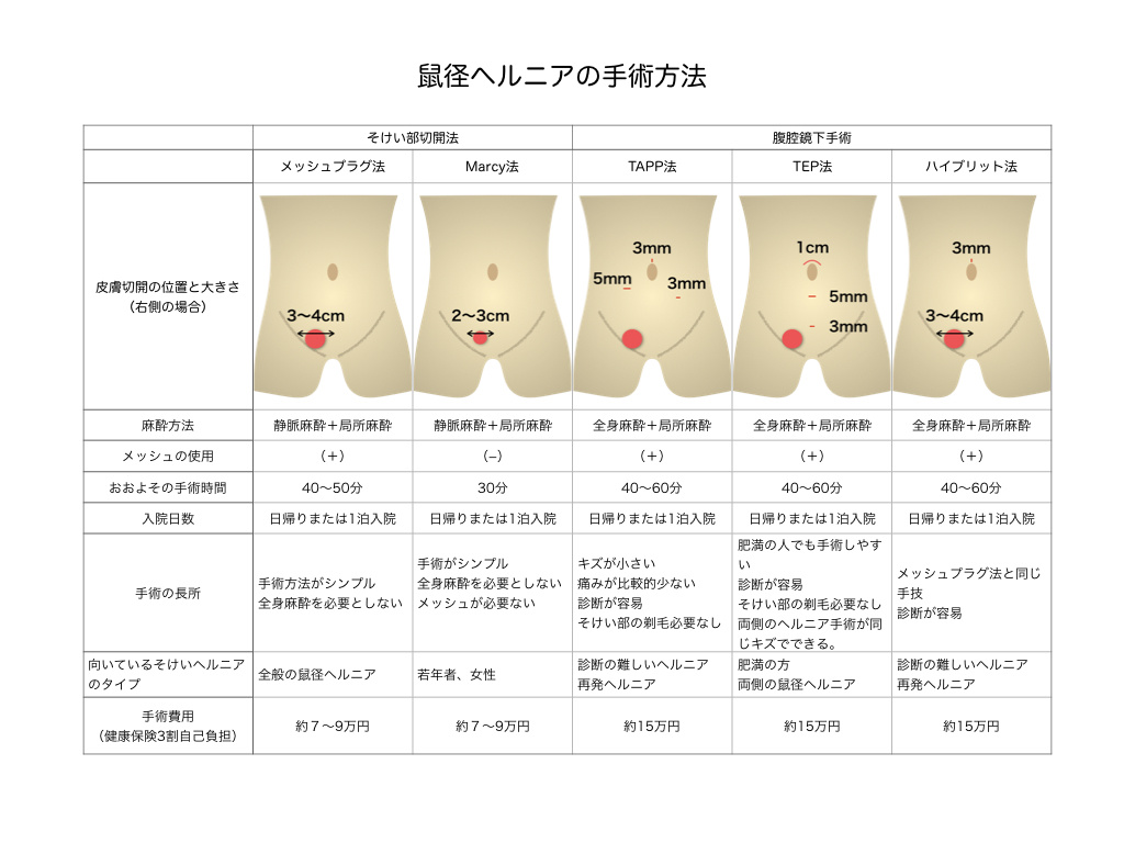 プロ監修】鼠径部リンパマッサージで、むくみのない、キレイな脚を目指す！｜コラム｜銀座ナチュラルタイム-銀座駅から徒歩1分の極上リンパマッサージ