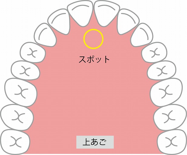 ザ！世界仰天ニュース』で紹介された「歯が原因ではない歯の痛みの謎」 | 名古屋トリガーポイント鍼灸院