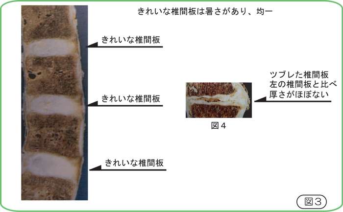 サブラクセーションとは？ – 島田市・藤枝市の整体院｜花みずきカイロプラクティック院