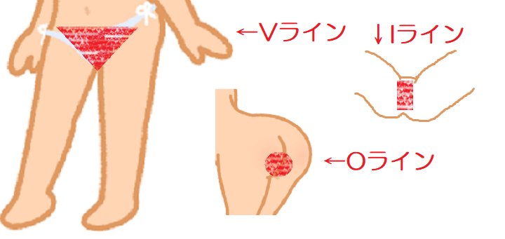 風俗と脱毛サロン同じだと思ってませんか？ - YouTube