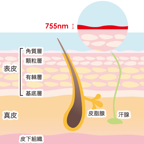 ちんげ（VIO）脱毛の痛みはどれくらい？痛い理由や軽減方法を解説 | お役立ち情報 | 東京・恵比寿のメンズ脱毛サロン【アロンソ】