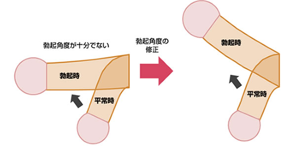 上向き収納が出来るメンズTバックを試しに買ってみました。 - Tバック男爵がメンズTバックについて語るブログ