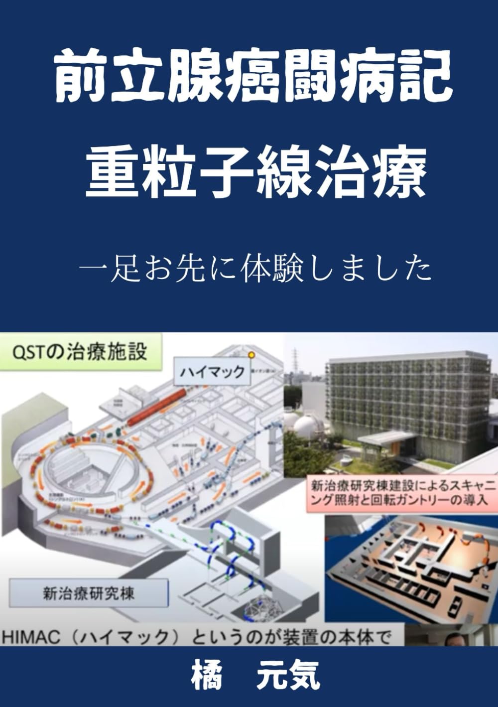 全身麻酔を使った8時間半の手術。術後3日目には創部への不安もなくなった｜2015年6月 前立腺がんの手術｜前立腺がん・前立腺 腫瘍のがん経験者「Tさん（70歳・男性）」の体験談｜tomosnote（トモスノート）