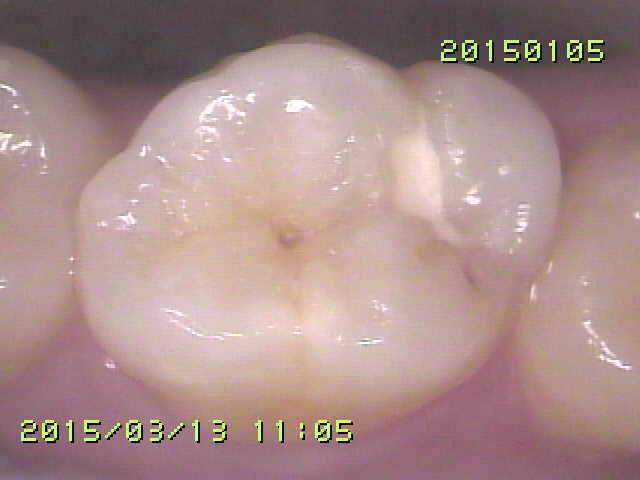 一般歯科・予防歯科中村区本陣の歯科・歯医者 奥村歯科医院 ネット予約