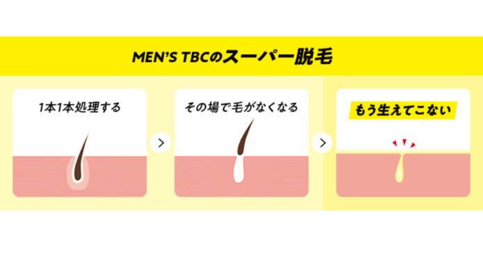 吉祥寺でメンズ脱毛・ヒゲ脱毛がおすすめの人気の医療クリニック＆サロン16選