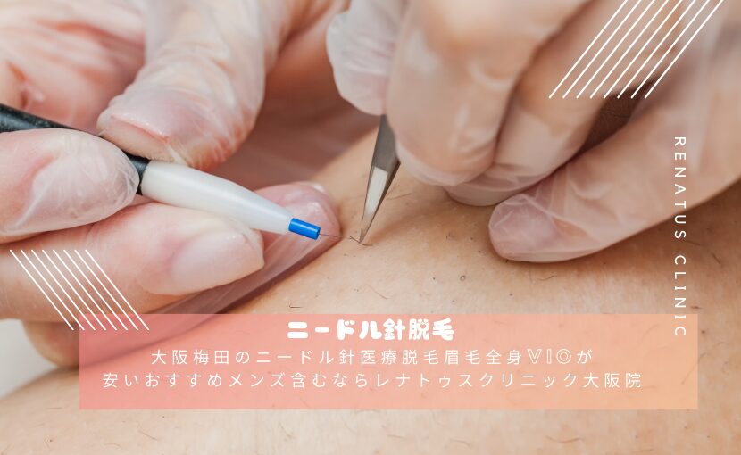 回数を重ねる毎に効果を実感いただけます｜メンズ脱毛サロン 髭職人VIO(ヴィオ)所属・メンズ脱毛ヒゲ職人 Vio大阪 梅田店のエステ・リラクカタログ(20221220164137)｜ミニモ